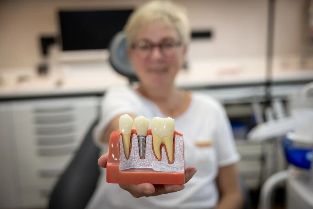Implantatmodell mit Schraube und Krone, Zahnimplantate Bad Oldesloe